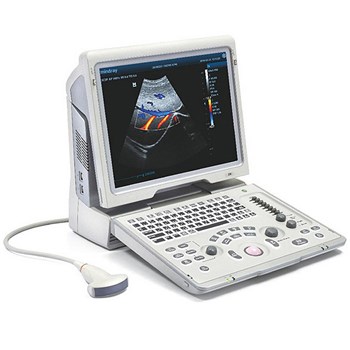 迈瑞Mindray便携式彩色多普勒超声诊断系统Z6