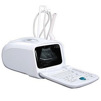 凯逊 全数字便携B超 KX668