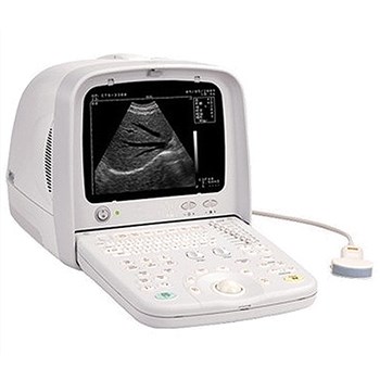 汕头B超 全数字超声显像诊断仪 CTS-3300