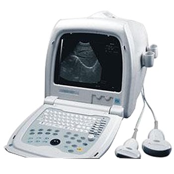 深圳恩普B超 便携式超声诊断仪 EMP-860
