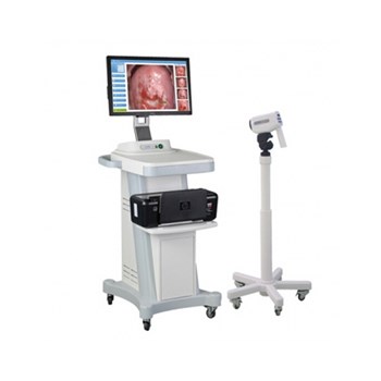 金舜康便携式电子阴道镜-配笔记本电脑（招标机型）GC-3000E 