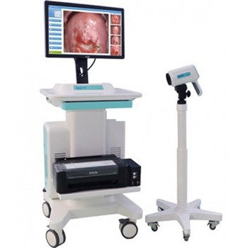 金舜康GOLDCARE高清电子阴道镜GC-5000B