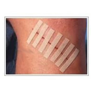 3M 皮肤免缝胶带，6mm×75mm R1541