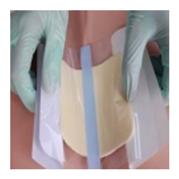 稳健医疗 泡沫敷料（有边型）