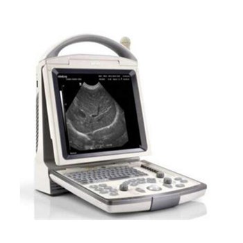 迈瑞全数字便携式超声系统DP-30