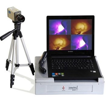 联创红外乳腺检查仪LC-8100B