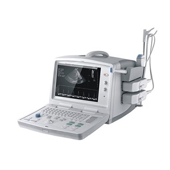中旗 便携式全数字超声系统 B型超声诊断仪ZQ-6602