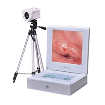  联创便携数码阴道镜LC-9100A