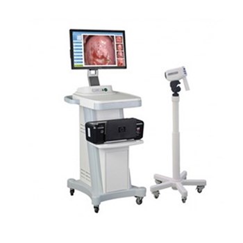 金舜康GOLDCARE高清电子阴道镜GC-3000B 