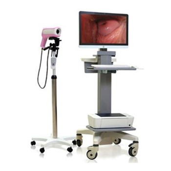 联创数码阴道镜LC-9100C（一体机）
