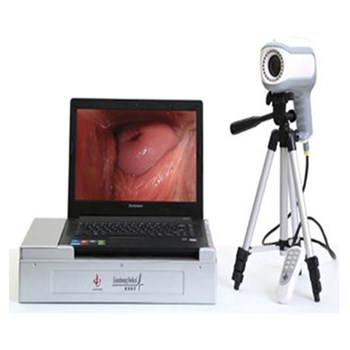 联创笔记本款数码阴道镜LC-9100B