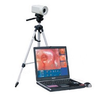 信达电子阴道镜工作站(便携式)XD-6000Y