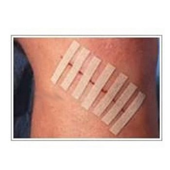 3M 皮肤免缝胶带,12mm×100mm R1547