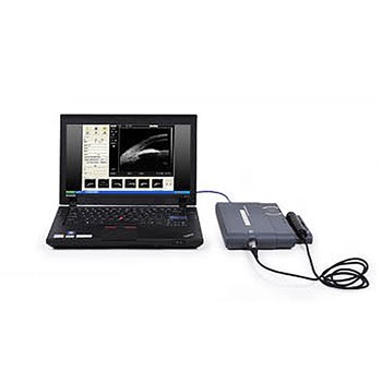 迈达 眼科超声生物显微镜MD-320W