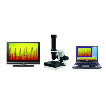 众联微循环检查仪（电脑电视双用型）ZL102