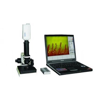 众联微循环检查仪（笔记本电脑式）ZL102