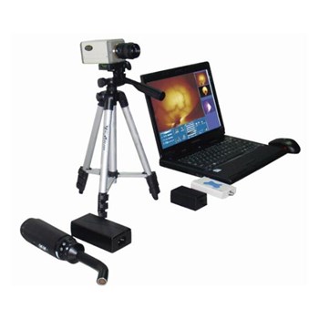 众联红外乳腺检查仪（笔记本电脑型）ZL502