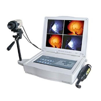 康拓医疗红外乳腺诊断仪KT-1000A