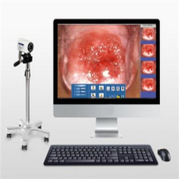 同人医疗数码电子阴道镜（笔记本便携式）TR6000C