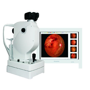 上邦免散瞳眼底照相机SK-550A