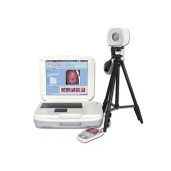 晨昊医疗数码电子阴道镜YKD-3004