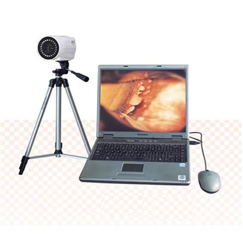 国健电子数码电子阴道镜（笔记本）GJ-8000B