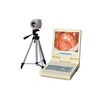 国健电子数码电子阴道镜（便携）GJ-8000A