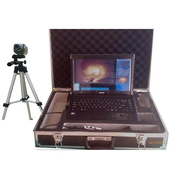 国健电子笔记本式红外乳腺诊断仪