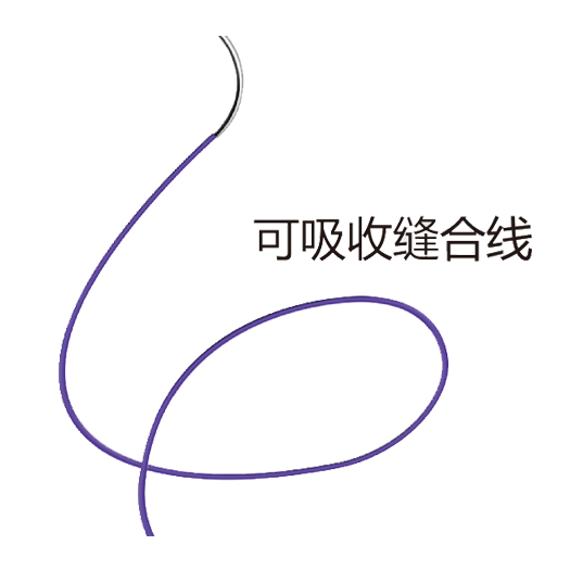 可吸收缝合线