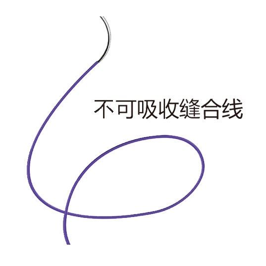 不可吸收缝合线